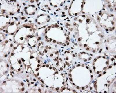 Immunohistochemistry-Paraffin: XRCC1 Antibody (OTI2F8) [NBP2-02280]
