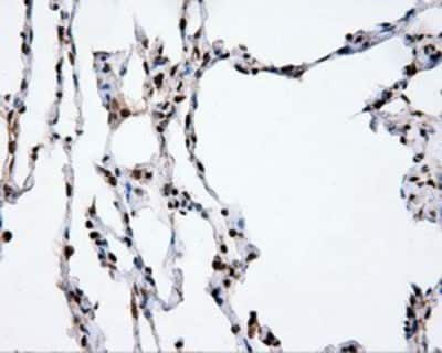 Immunohistochemistry-Paraffin: XRCC1 Antibody (OTI2F8) [NBP2-02280]