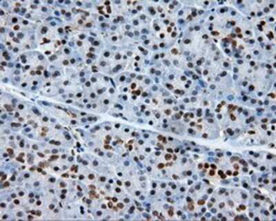 Immunohistochemistry-Paraffin: XRCC1 Antibody (OTI2F8) [NBP2-02280]