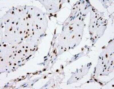 Immunohistochemistry-Paraffin: XRCC1 Antibody (OTI2F8) [NBP2-02280]