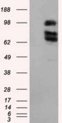 Western Blot: XRCC1 Antibody (OTI2F8) [NBP2-02280]