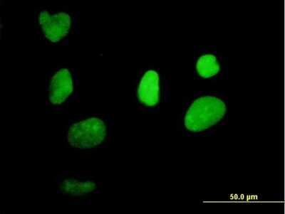 Immunocytochemistry/ Immunofluorescence: XRCC1 Antibody [H00007515-B01P]