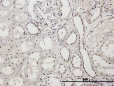 Immunohistochemistry-Paraffin: XRCC1 Antibody [H00007515-B01P]