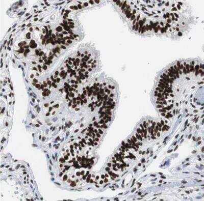 Immunohistochemistry-Paraffin: XRCC1 Antibody [NBP1-87154]