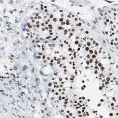 Immunohistochemistry-Paraffin: XRCC1 Antibody [NBP1-87154]