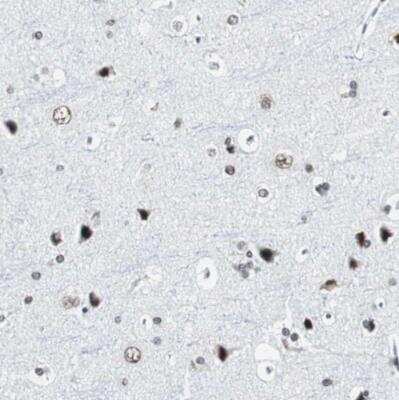 Immunohistochemistry-Paraffin: XRCC1 Antibody [NBP1-87154]