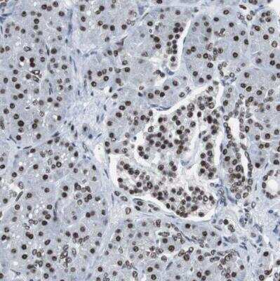 Immunohistochemistry-Paraffin: XRCC1 Antibody [NBP1-87154]