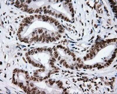 Immunohistochemistry: XRCC1 Antibody (OTI2F8) - Azide and BSA Free [NBP2-74891]