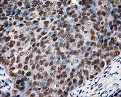 Immunohistochemistry: XRCC1 Antibody (OTI2F8) - Azide and BSA Free [NBP2-74891]