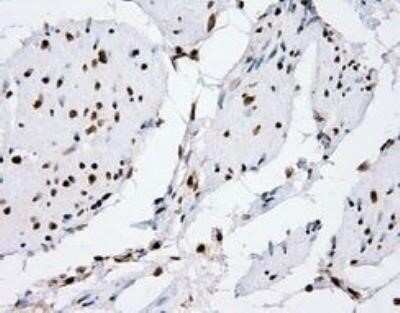 Immunohistochemistry: XRCC1 Antibody (OTI2F8) - Azide and BSA Free [NBP2-74891]