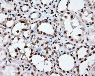 Immunohistochemistry: XRCC1 Antibody (OTI2F8) - Azide and BSA Free [NBP2-74891]
