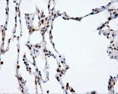 Immunohistochemistry: XRCC1 Antibody (OTI2F8) - Azide and BSA Free [NBP2-74891]