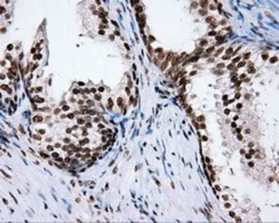 Immunohistochemistry: XRCC1 Antibody (OTI2F8) - Azide and BSA Free [NBP2-74891]