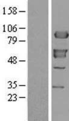 Western Blot: XRCC1 Overexpression Lysate [NBL1-17913]