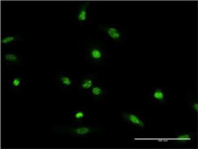 Immunocytochemistry/ Immunofluorescence: XRCC2 Antibody (2H4) [H00007516-M01]