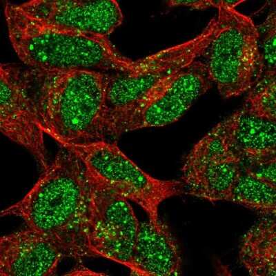 Immunocytochemistry/ Immunofluorescence: XRCC2 Antibody [NBP2-56170]