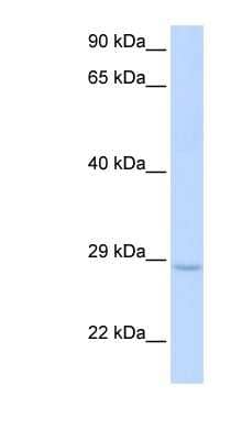 Western Blot: XRCC2 Antibody [NBP1-58119]