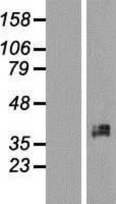 Western Blot: XRCC2 Overexpression Lysate [NBL1-17914]