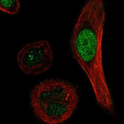 Immunocytochemistry/ Immunofluorescence: XRCC3 Antibody [NBP2-55943]