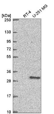 Western Blot: XRCC3 Antibody [NBP2-56545]