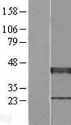 Western Blot: XRCC3 Overexpression Lysate [NBP2-08248]