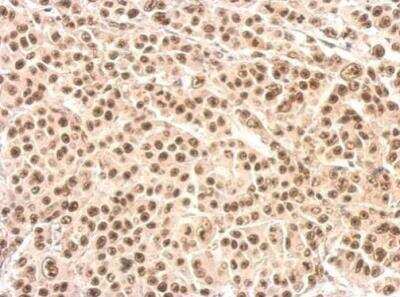 Immunohistochemistry-Paraffin: XRCC4 Antibody [NBP1-30878]