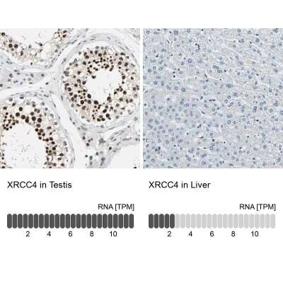 Immunohistochemistry-Paraffin: XRCC4 Antibody [NBP1-89463]