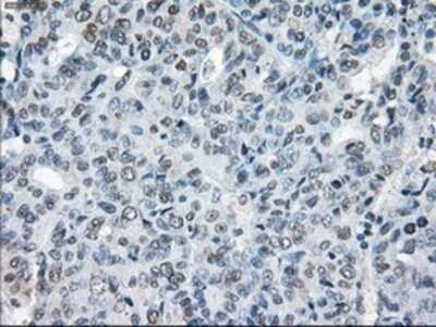 Immunohistochemistry: XRCC4 Antibody (OTI4H9) - Azide and BSA Free [NBP2-74896]