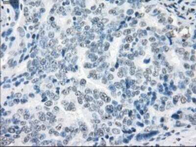 Immunohistochemistry: XRCC4 Antibody (OTI4H9) - Azide and BSA Free [NBP2-74896]