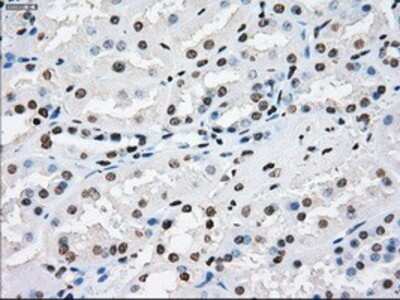 Immunohistochemistry: XRCC4 Antibody (OTI4H9) - Azide and BSA Free [NBP2-74896]