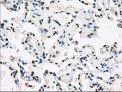 Immunohistochemistry: XRCC4 Antibody (OTI4H9) - Azide and BSA Free [NBP2-74896]