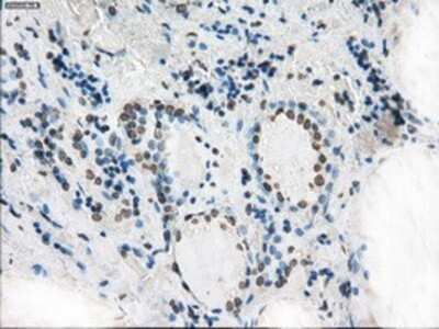 Immunohistochemistry: XRCC4 Antibody (OTI4H9) - Azide and BSA Free [NBP2-74896]