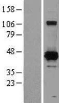 Western Blot: XRCC4 Overexpression Lysate [NBL1-17916]