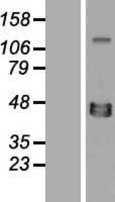 Western Blot: XRCC4 Overexpression Lysate [NBP2-08016]