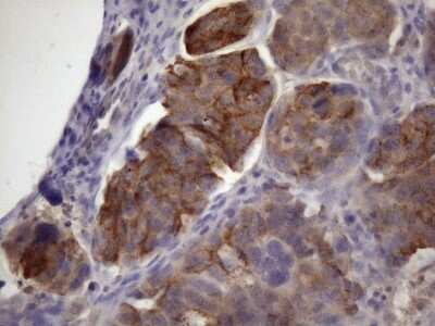 Immunohistochemistry: XRCC6BP1 Antibody (OTI5F3) [NBP2-46374]