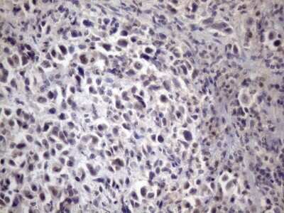 Immunohistochemistry: XRCC6BP1 Antibody (OTI5F3) [NBP2-46374]