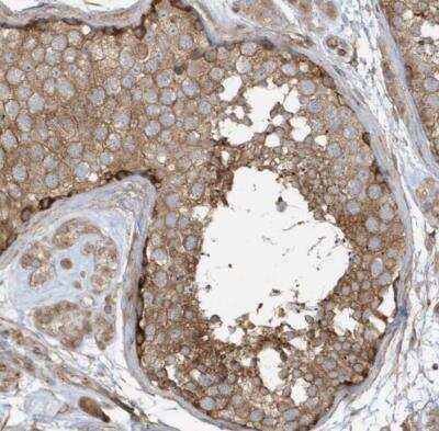 Immunohistochemistry-Paraffin: XRCC6BP1 Antibody [NBP1-81339]