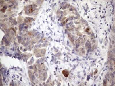 Immunohistochemistry: XRCC6BP1 Antibody (OTI5F3) - Azide and BSA Free [NBP2-74897]