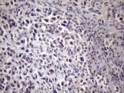 Immunohistochemistry: XRCC6BP1 Antibody (OTI5F3) - Azide and BSA Free [NBP2-74897]