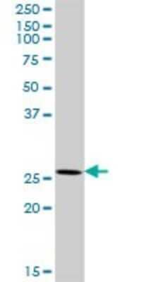 Western Blot: XRCC6BP1 Antibody [H00091419-D01P]