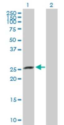 Western Blot: XRCC6BP1 Antibody [H00091419-D01P]