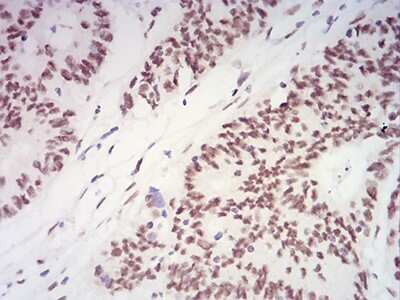 Immunohistochemistry: XRN2 Antibody (9F7G11) - BSA Free [NBP2-61839]