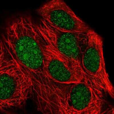 Immunocytochemistry/ Immunofluorescence: XRN2 Antibody [NBP2-54940]