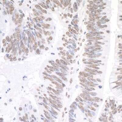 Immunohistochemistry-Paraffin: XRN2 Antibody [NB100-57541]