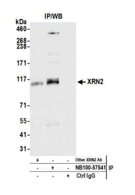 Immunoprecipitation: XRN2 Antibody [NB100-57541]