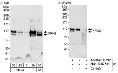 Western Blot: XRN2 Antibody [NB100-57539]