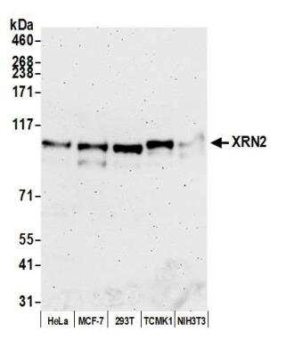 Western Blot: XRN2 Antibody [NB100-57539]