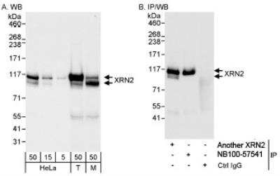 Western Blot: XRN2 Antibody [NB100-57540]