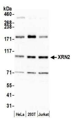 Western Blot: XRN2 Antibody [NB100-57541]