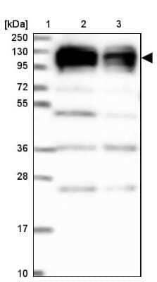 Western Blot: XRN2 Antibody [NBP2-13529]